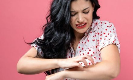 Natural Remedies for Fire Ant Bites: How to Deal With Fire Ant Injuries