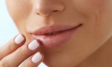 What is the Best Lip Balm for Dark Lips: Top Lip Balms for Darker Lips