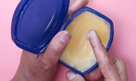 Can You Eat Petroleum Jelly: What Happens If You Eat Vaseline?