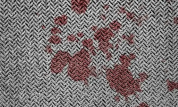 How to Get Stains Out of Wool