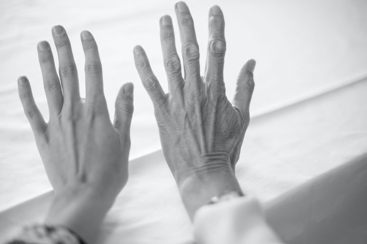 coconut oil and baking soda for wrinkles