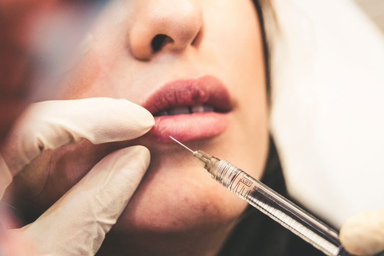 What to expect when dissolving lip fillers?
