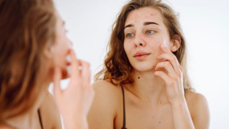 Is Skin Cycling Still Worth It?