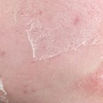 7 Signs Your Skin Barrier Is Damaged (And How to Fix It)